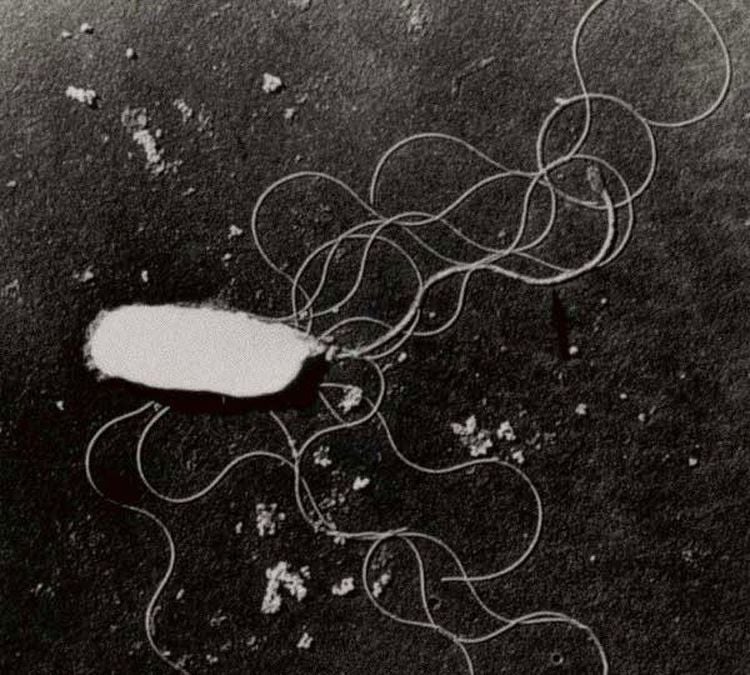 
Hình ảnh vi khuẩn Vibrio Parahaemolyticus
