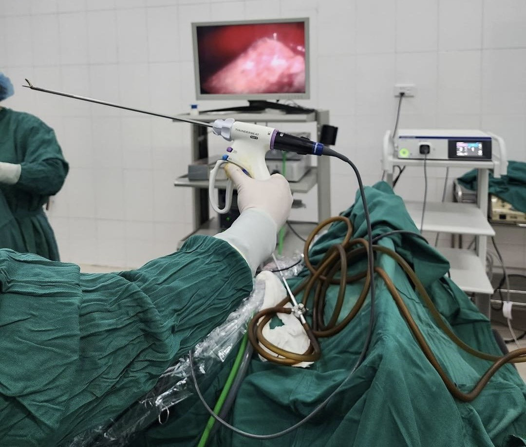 Ứng dụng dao siêu âm trong phẫu thuật tại bệnh viện Đa khoa Diễn Châu